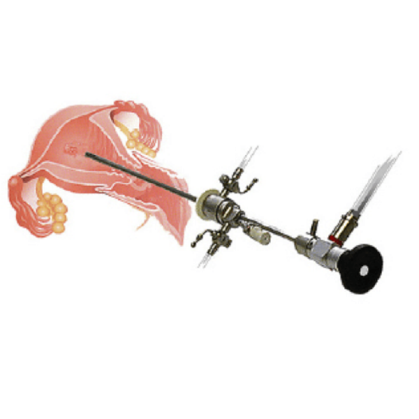 Karl Storz Hysteroscopy Set