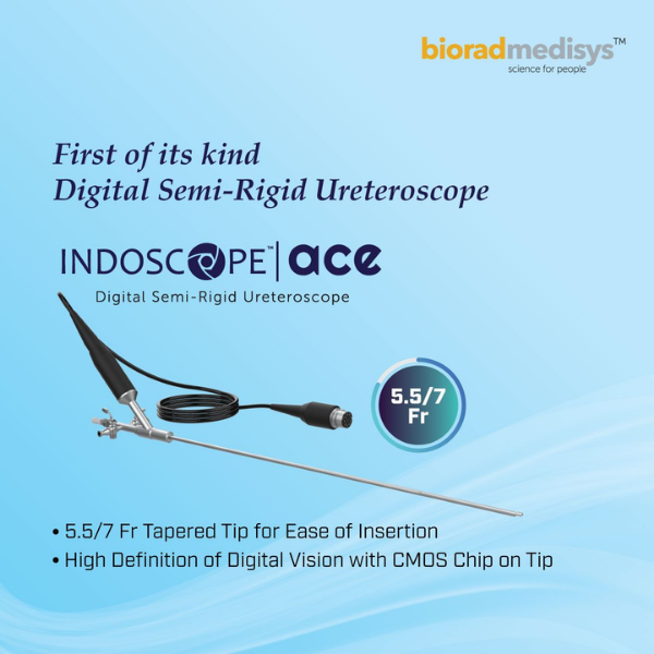 ACE Digital Semi-Rigid Ureteroscope